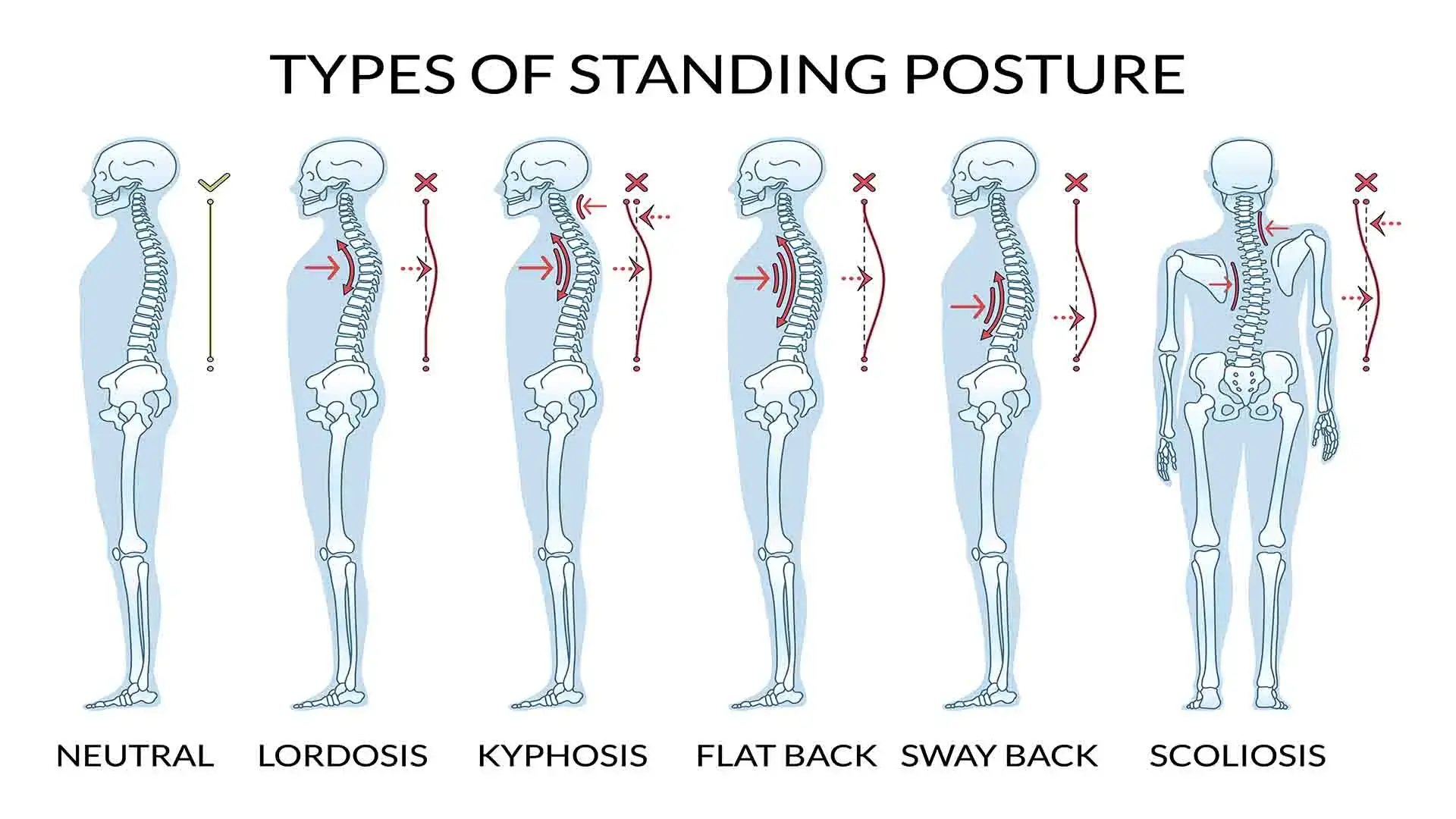 Why Posture matters